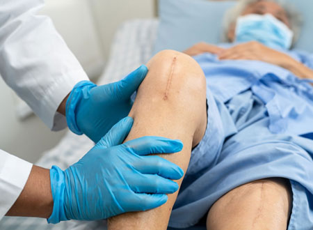 Knee Replacement Recovery