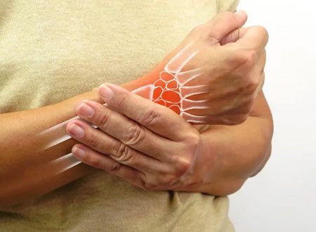 Arthritis Treatment