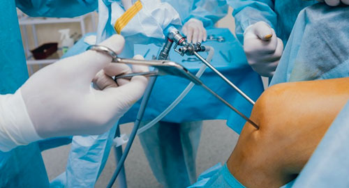 Minimally Invasive Knee Replacement Surgery